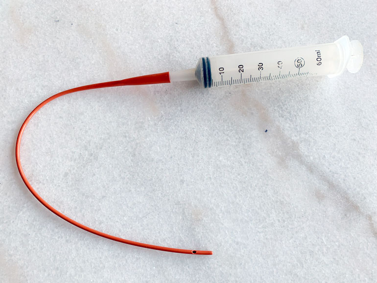 Stomach tube feeding kit of a stomach tub and large syringe